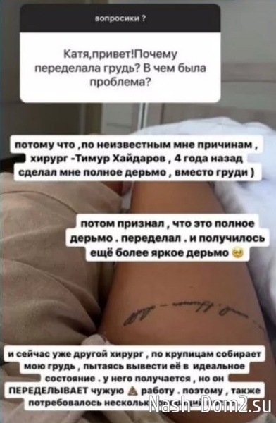 Скалон призналась, что грудь ей испортил Тимур Хайдаров