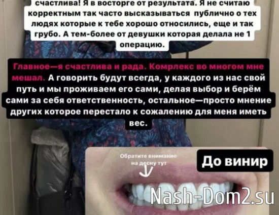 Зрители проекта шокированы новыми винирами Иры Пингвиновой