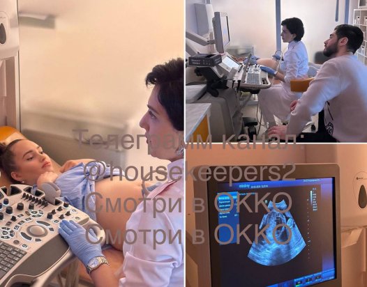 Тигран и Виктория Салибековы поделились фото с 3D УЗИ будущего ребёнка