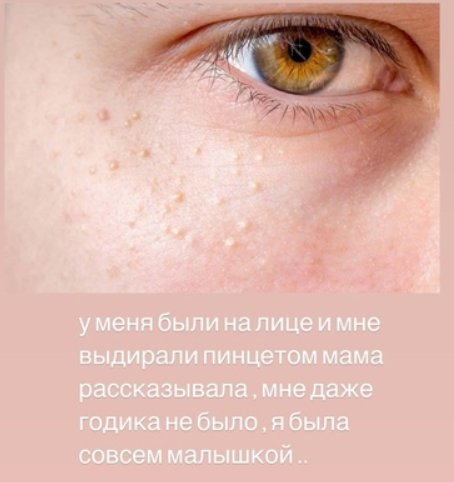 Сыну Аниты Кобелевой и Фёдора Стрелкова сделали операцию