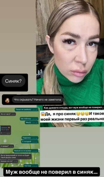 Надежда Ермакова пожаловалась на побои от соседки
