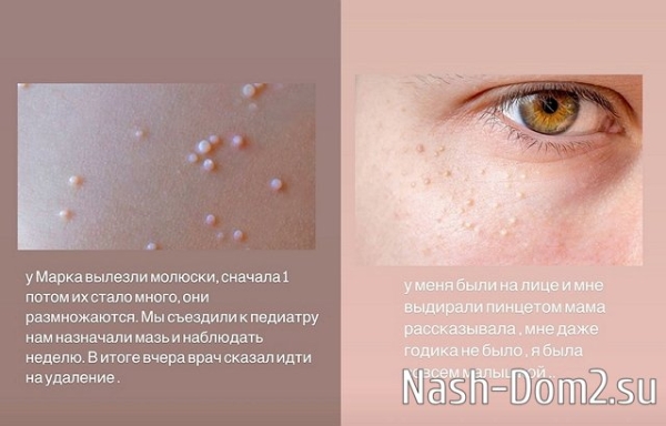 Сын Стрелковых стойко перенёс операцию