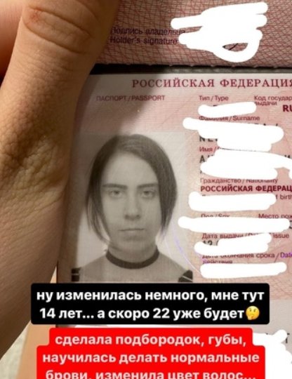 Кенели Сайкс показала, как она выглядела в 14 лет до пластики