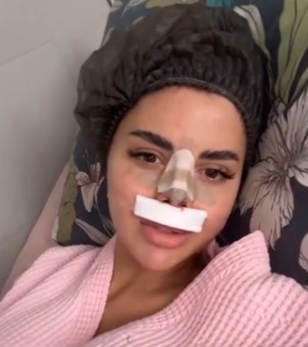Яна Шафеева сделала новую ринопластику