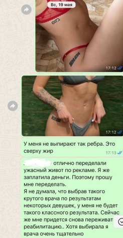 Милена Безбородова пожаловалась на халатность хирурга и будет переделывать "фигуру"
