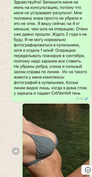 Милена Безбородова пожаловалась на халатность хирурга и будет переделывать "фигуру"