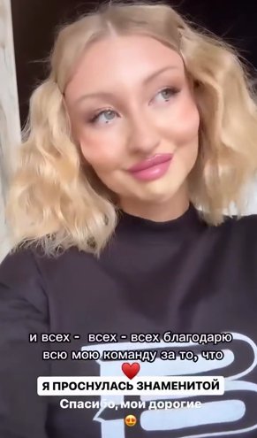 Марго Овсянникова проснулась знаменитой после изменения скул