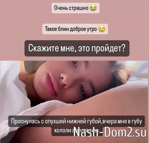 Эльвира Гох: Скажите мне, это пройдёт?