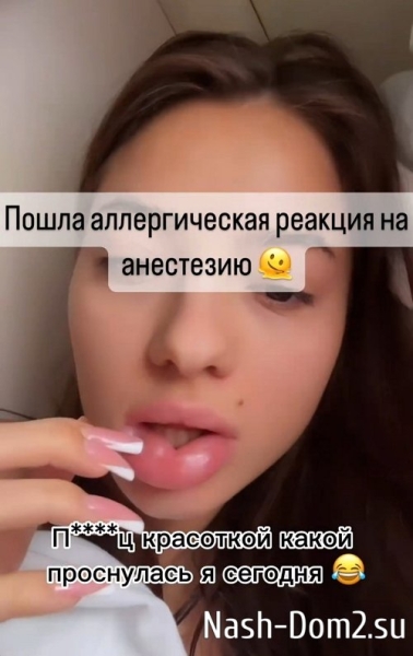 Эльвира Гох: Скажите мне, это пройдёт?