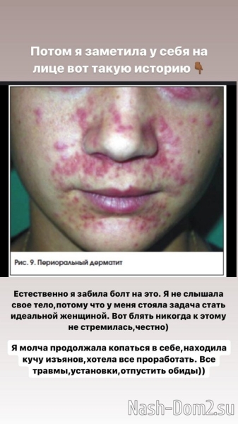 Алёна Опенченко: Сложно об этом рассказывать... Алёна Опенченко: Сложно об этом рассказывать...