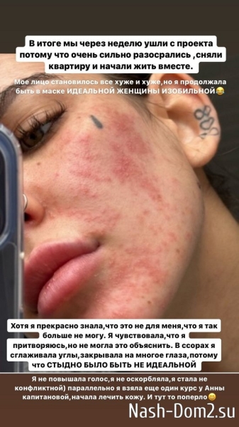 Алёна Опенченко: Сложно об этом рассказывать... Алёна Опенченко: Сложно об этом рассказывать...