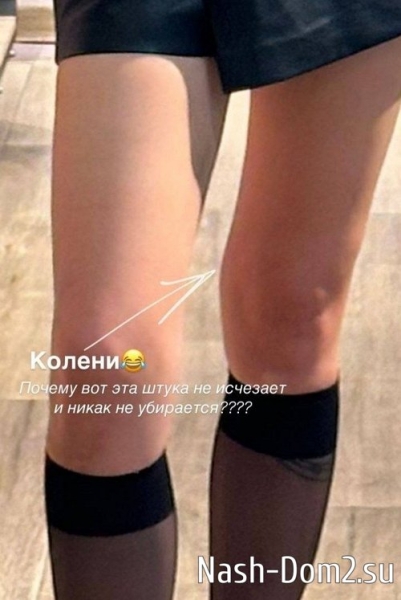 Алёна Опенченко: Хочу ровные ноги