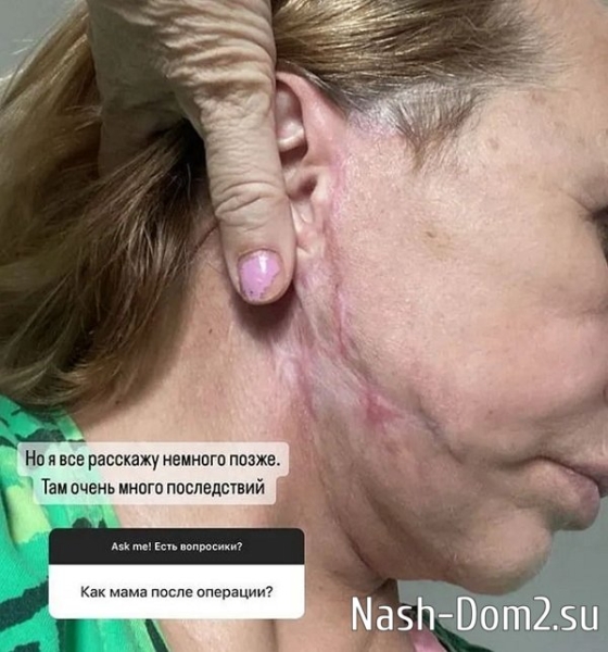 Мама Виктории Бони подала в суд на пластического хирурга Мама Виктории Бони подала в суд на пластического хирурга