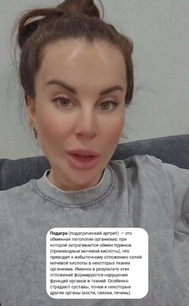 У Ольги Ветер обнаружили подагру