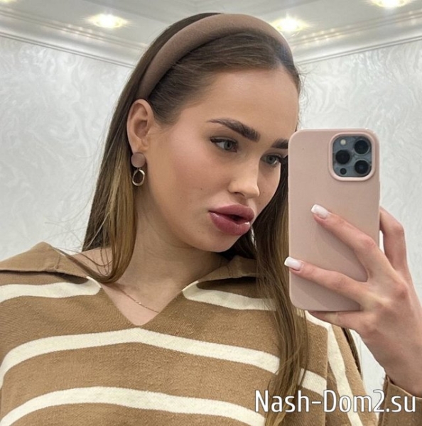 Виктория Салибекова меняет форму губ