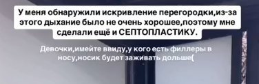 Анна Самонина поделилась советами после ринопластики