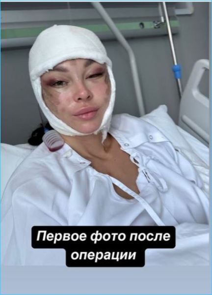 Антону Гусеву стоит обратиться к Насте Лисовой за опытом круговой пластической операции