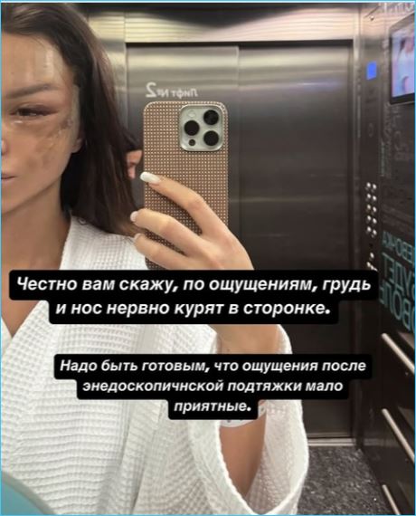 Антону Гусеву стоит обратиться к Насте Лисовой за опытом круговой пластической операции