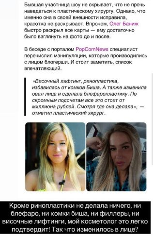 Надежда Ермакова возмущена слухами про её блефаропластику