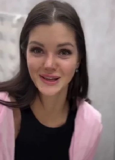 Анна Самонина после ринопластики решила поставить виниры