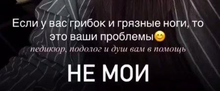 Татьяна Капаклы посоветовала подписчицам лечить грибок