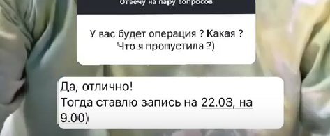 Иосиф Оганесян озвучил дату пересадки волос