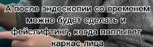 Надежда Ермакова рассказала, сколько заплатит за 5 лет молодости и красоты