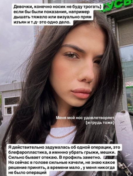 Ирина Пингвинова из-за страхов перенесла блефаропластику