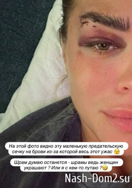 Анастасия Балинская: Меня впервые подвели мои туфли