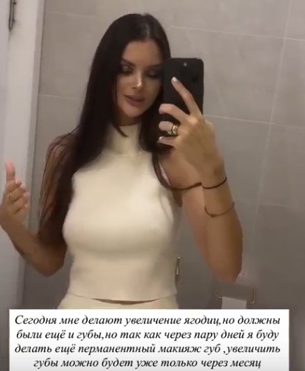 Анна Самонина увеличила ягодицы Анна Самонина увеличила ягодицы