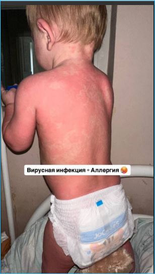 Вместо интересного контента Анна Евстропова оказалась с дочкой Анджелиной в больнице