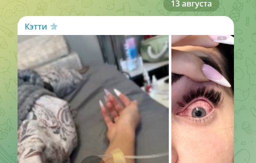 Катя Скалон рассказала, как превратилась в зомби