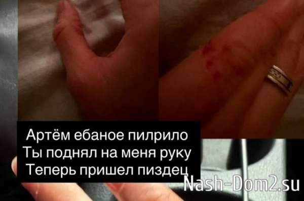 Анна Брянская стала жертвой абьюзера