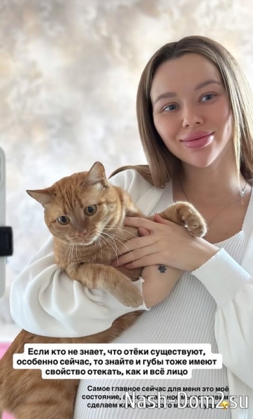 Татьяна Репина: Губы тоже имеют свойство отекать Татьяна Репина: Губы тоже имеют свойство отекать