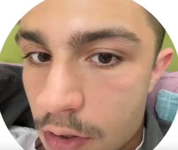 Никита Гуранда подозревает, что у него проблемы с почками Никита Гуранда подозревает, что у него проблемы с почками