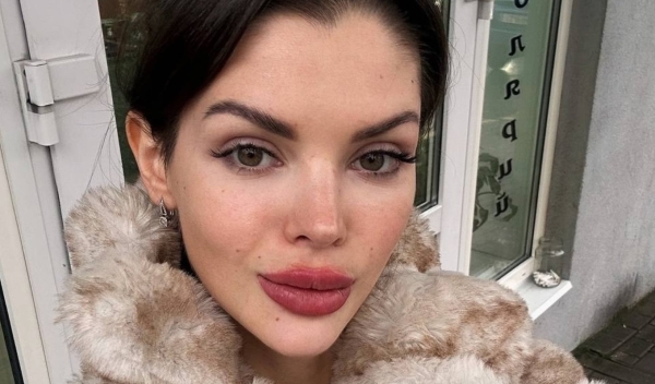 Анна Самонина обещала подписчикам не "качать" губы Анна Самонина обещала подписчикам не "качать" губы