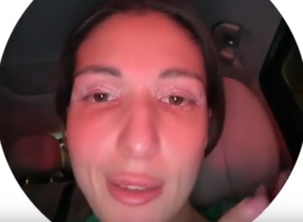 Яна Захарова сделала блефаропластику Яна Захарова сделала блефаропластику