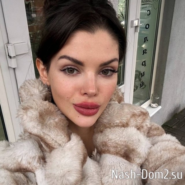 Анна Евстропова прозрела и больше не будет делать губы Анна Евстропова прозрела и больше не будет делать губы