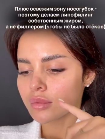 Яна Шафеева рассказала, какая операция превратила её в "китаянку" Яна Шафеева рассказала, какая операция превратила её в "китаянку"