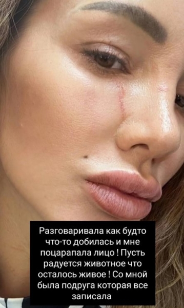 Клавдия Безверхова объяснила, почему расцарапала лицо мамы и прекратила общаться Клавдия Безверхова объяснила, почему расцарапала лицо мамы и прекратила общаться