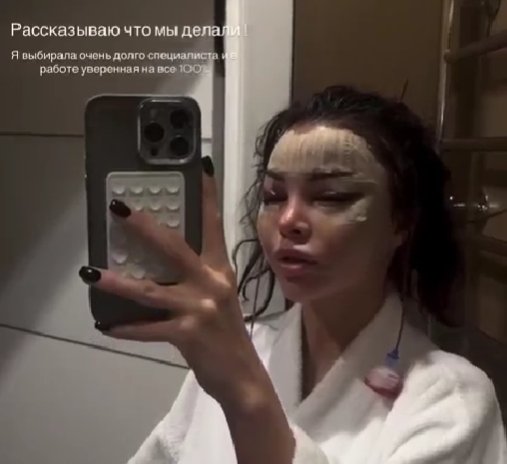 Яна Шафеева рассказала, какая операция превратила её в "китаянку" Яна Шафеева рассказала, какая операция превратила её в "китаянку"