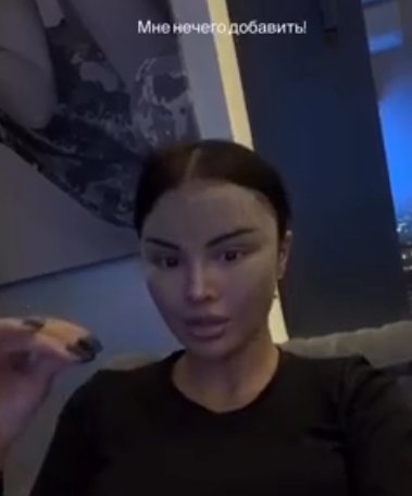 Яна Шафеева рассказала, какая операция превратила её в "китаянку" Яна Шафеева рассказала, какая операция превратила её в "китаянку"