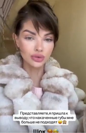 Анна Самонина обещала подписчикам не "качать" губы Анна Самонина обещала подписчикам не "качать" губы