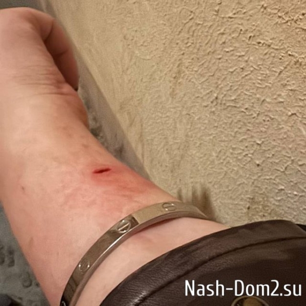 Александра Черно обзавелась личным сталкером