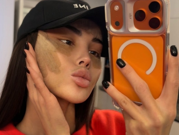 Яна Шафеева рассказала, какая операция превратила её в "китаянку" Яна Шафеева рассказала, какая операция превратила её в "китаянку"