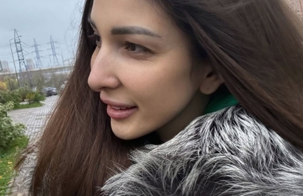 Яна Захарова сделала блефаропластику Яна Захарова сделала блефаропластику