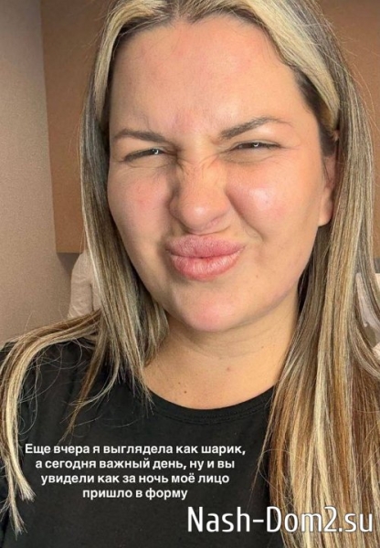 Майя Донцова подправила своё лицо с помощью ботокса Майя Донцова подправила своё лицо с помощью ботокса