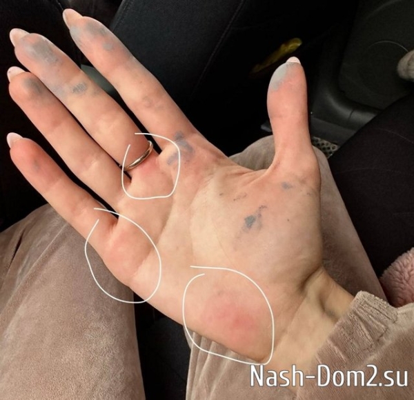 Трудотерапия спасает семью Евстроповых Трудотерапия спасает семью Евстроповых