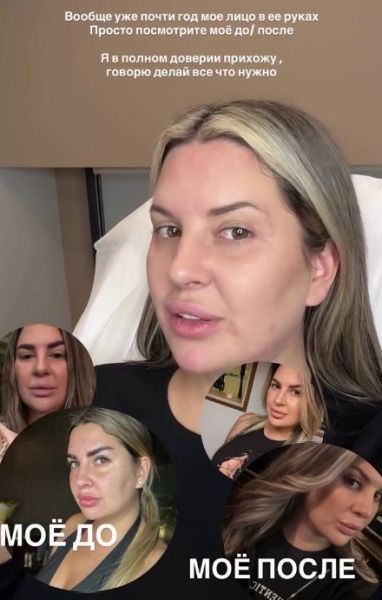 Майя Донцова устала ходить с лицом, как воздушный шар Майя Донцова устала ходить с лицом, как воздушный шар