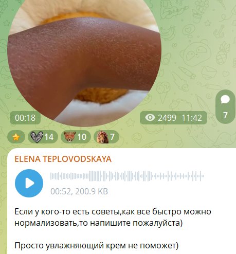 У Елены Тепловодской произошло ЧП перед важными съемками У Елены Тепловодской произошло ЧП перед важными съемками